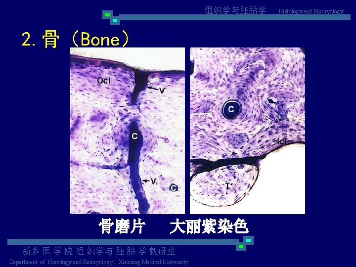组织学与胚胎学 2. 骨（Bone） 骨磨片 大丽紫染色 新乡 医 学 院 组 织学与 胚 胎 学