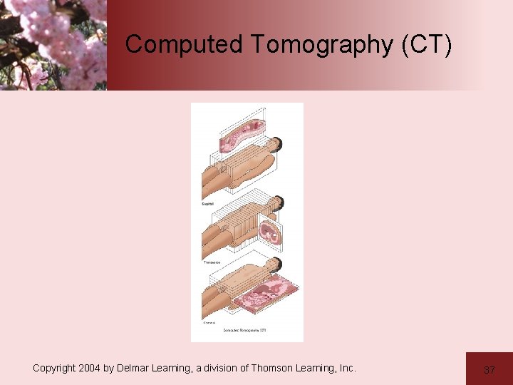 Computed Tomography (CT) Copyright 2004 by Delmar Learning, a division of Thomson Learning, Inc.