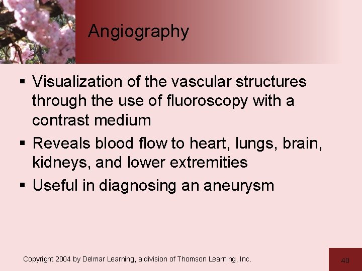 Angiography § Visualization of the vascular structures through the use of fluoroscopy with a