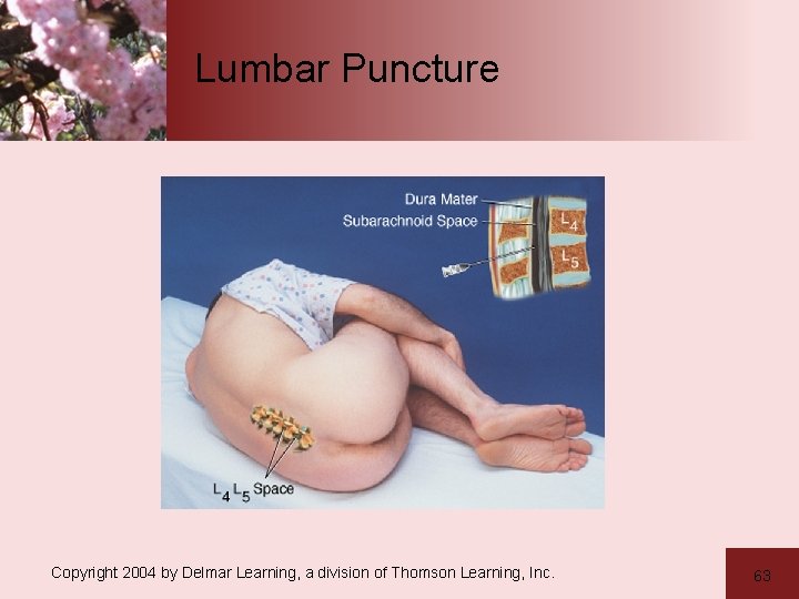 Lumbar Puncture Copyright 2004 by Delmar Learning, a division of Thomson Learning, Inc. 63