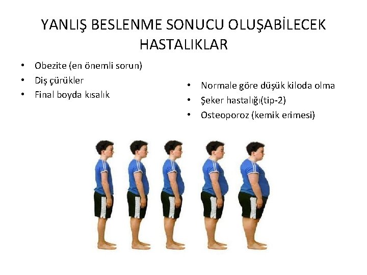 YANLIŞ BESLENME SONUCU OLUŞABİLECEK HASTALIKLAR • Obezite (en önemli sorun) • Diş çürükler •