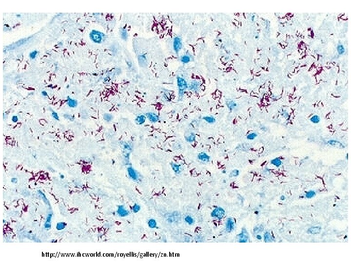 http: //www. ihcworld. com/royellis/gallery/zn. htm 