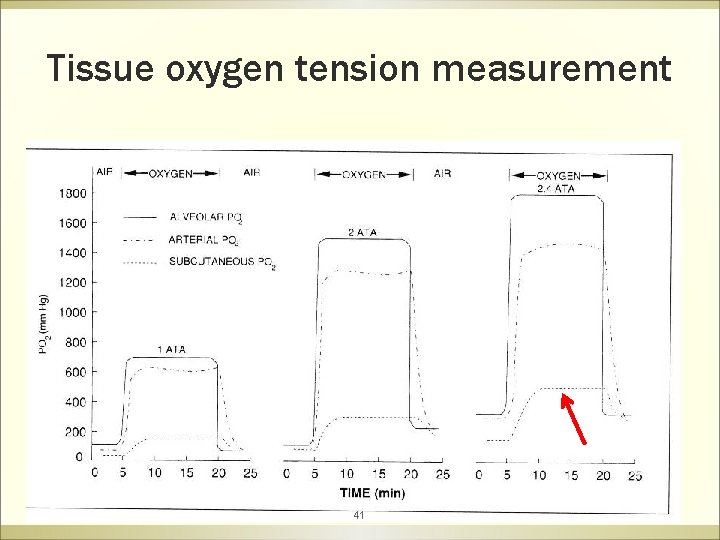 Tissue oxygen tension measurement 41 
