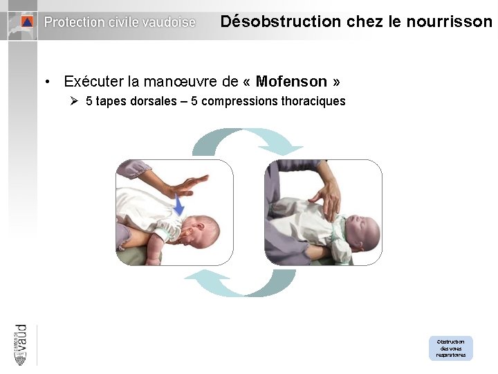 Désobstruction chez le nourrisson • Exécuter la manœuvre de « Mofenson » Ø 5