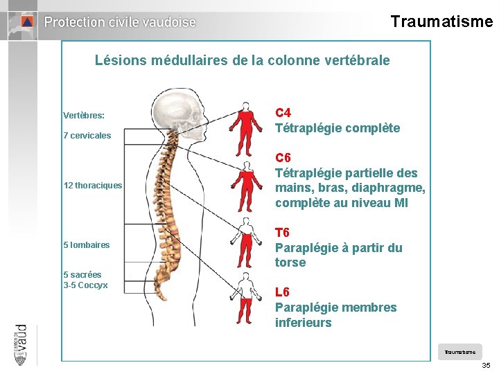 Traumatisme Lésions médullaires de la colonne vertébrale Vertèbres: 7 cervicales 12 thoraciques 5 lombaires