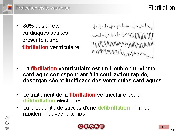 Fibrillation • 80% des arrêts cardiaques adultes présentent une fibrillation ventriculaire • La fibrillation