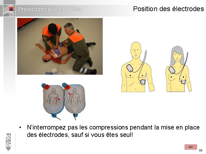 Position des électrodes • N’interrompez pas les compressions pendant la mise en place des