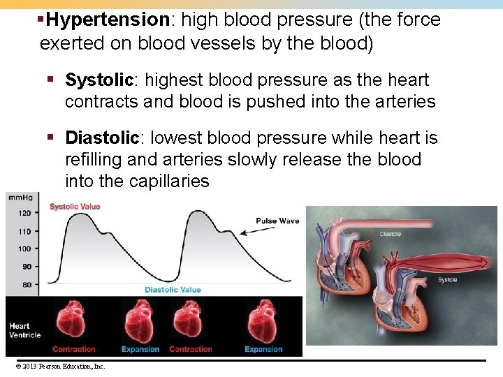 §Hypertension: high blood pressure (the force exerted on blood vessels by the blood) §