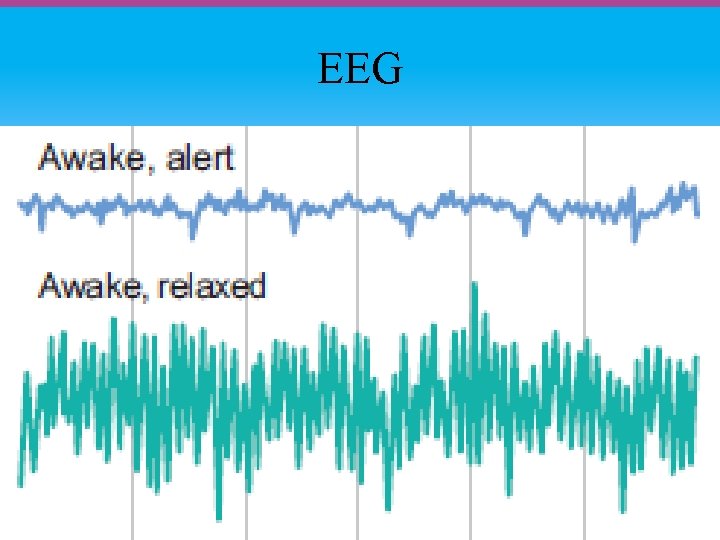 EEG 
