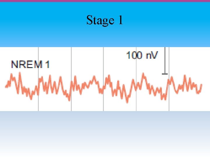 Stage 1 