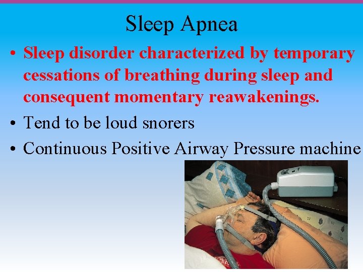 Sleep Apnea • Sleep disorder characterized by temporary cessations of breathing during sleep and