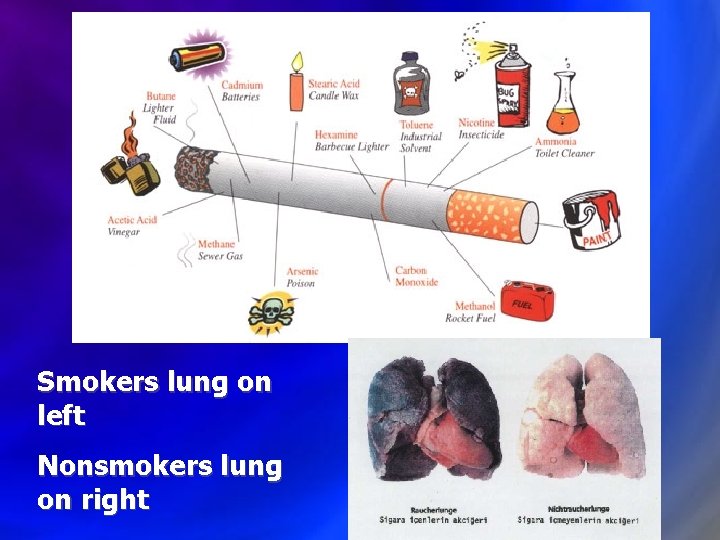 Smokers lung on left Nonsmokers lung on right 