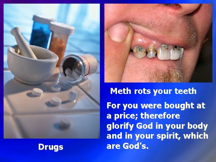 Meth rots your teeth Drugs For you were bought at a price; therefore glorify