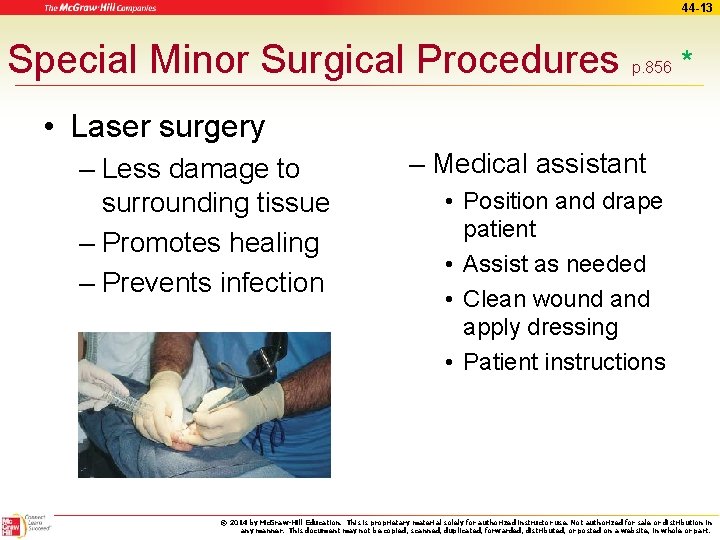 44 -13 Special Minor Surgical Procedures p. 856 * • Laser surgery – Less