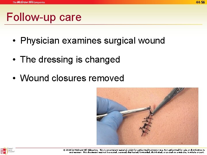 44 -56 Follow-up care • Physician examines surgical wound • The dressing is changed