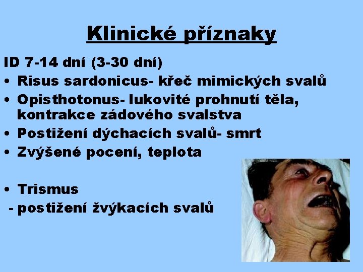 Klinické příznaky ID 7 -14 dní (3 -30 dní) • Risus sardonicus- křeč mimických