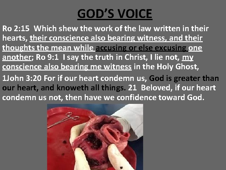 GOD’S VOICE Ro 2: 15 Which shew the work of the law written in
