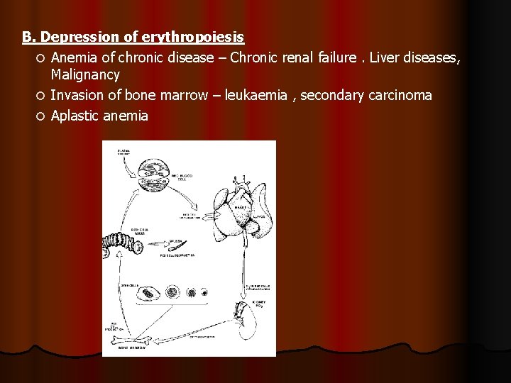 B. Depression of erythropoiesis Anemia of chronic disease – Chronic renal failure. Liver diseases,