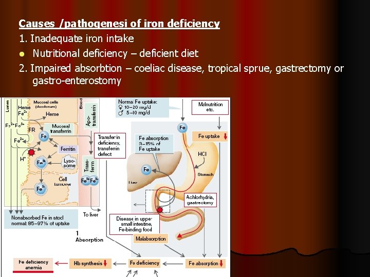 Causes /pathogenesi of iron deficiency 1. Inadequate iron intake l Nutritional deficiency – deficient