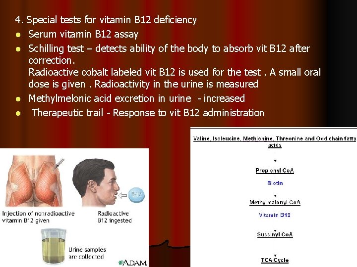 4. Special tests for vitamin B 12 deficiency l Serum vitamin B 12 assay