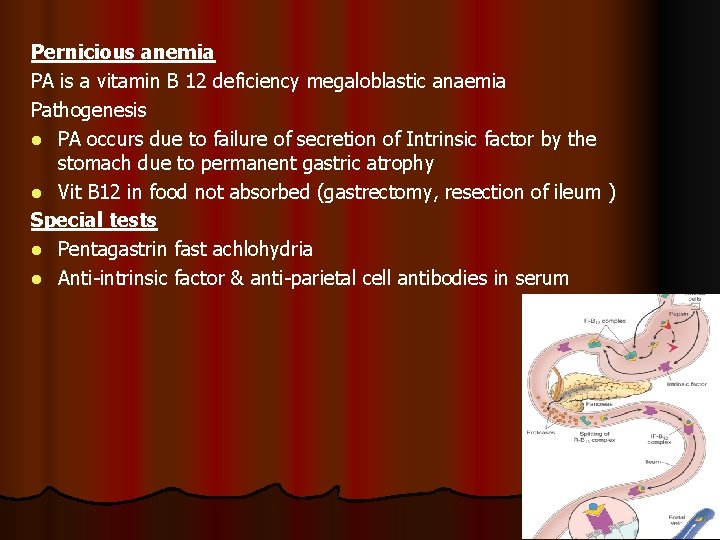 Pernicious anemia PA is a vitamin B 12 deficiency megaloblastic anaemia Pathogenesis l PA