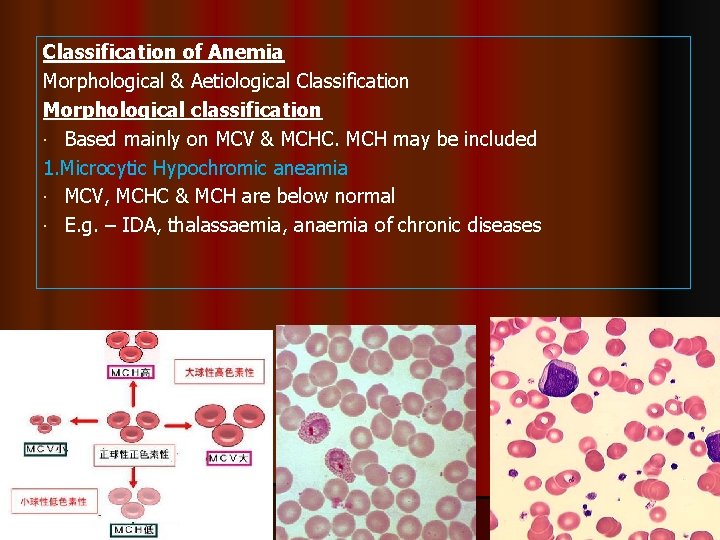 Classification of Anemia Morphological & Aetiological Classification Morphological classification Based mainly on MCV &