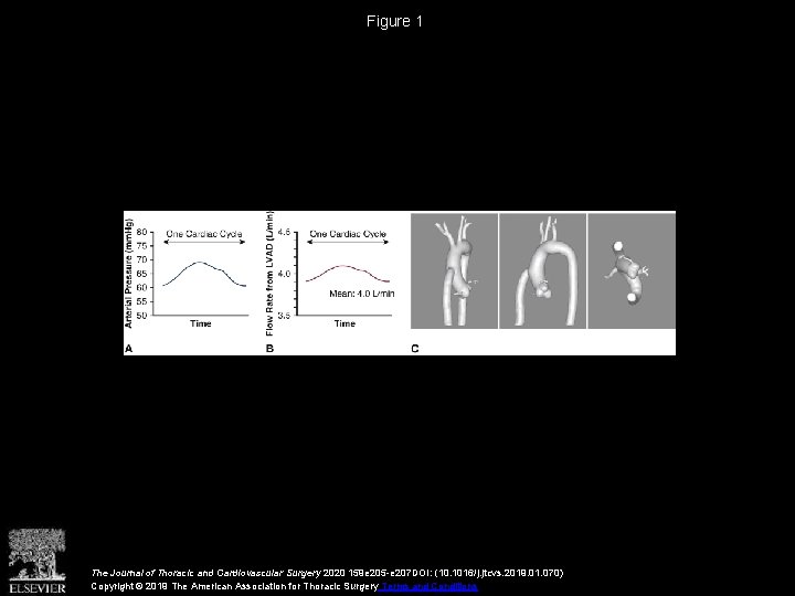 Figure 1 The Journal of Thoracic and Cardiovascular Surgery 2020 159 e 205 -e