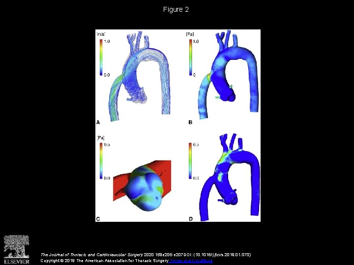 Figure 2 The Journal of Thoracic and Cardiovascular Surgery 2020 159 e 205 -e