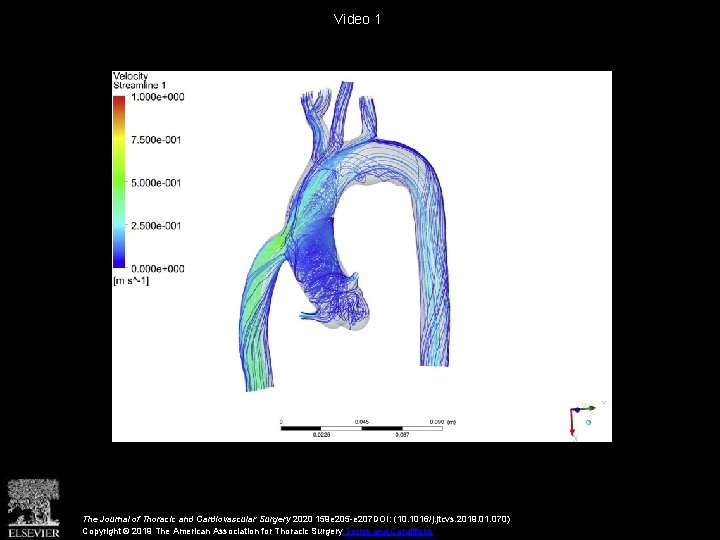 Video 1 The Journal of Thoracic and Cardiovascular Surgery 2020 159 e 205 -e