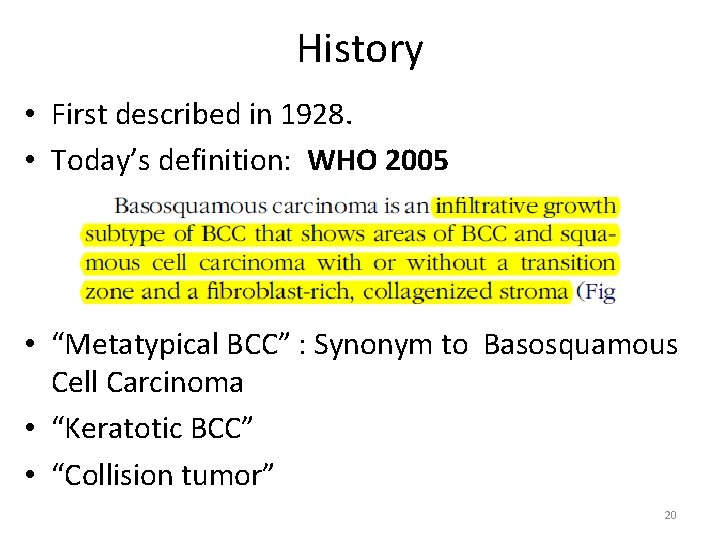 History • First described in 1928. • Today’s definition: WHO 2005 • “Metatypical BCC” History • First described in 1928. • Today’s definition: WHO 2005 • “Metatypical BCC”
