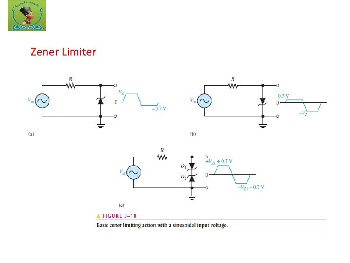 Zener Limiter 