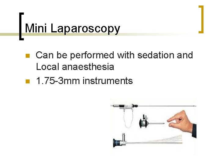 Mini Laparoscopy n n Can be performed with sedation and Local anaesthesia 1. 75