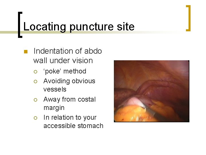 Locating puncture site n Indentation of abdo wall under vision ¡ ¡ ‘poke’ method