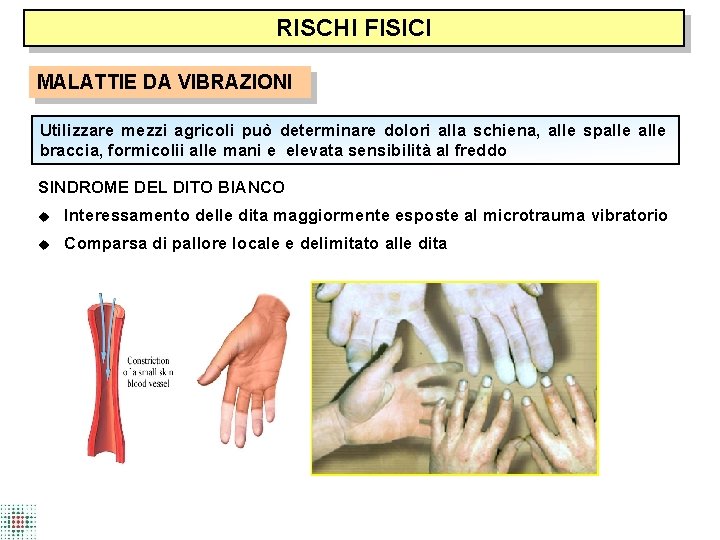 RISCHI FISICI MALATTIE DA VIBRAZIONI Utilizzare mezzi agricoli può determinare dolori alla schiena, alle