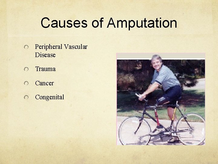 Causes of Amputation Peripheral Vascular Disease Trauma Cancer Congenital 
