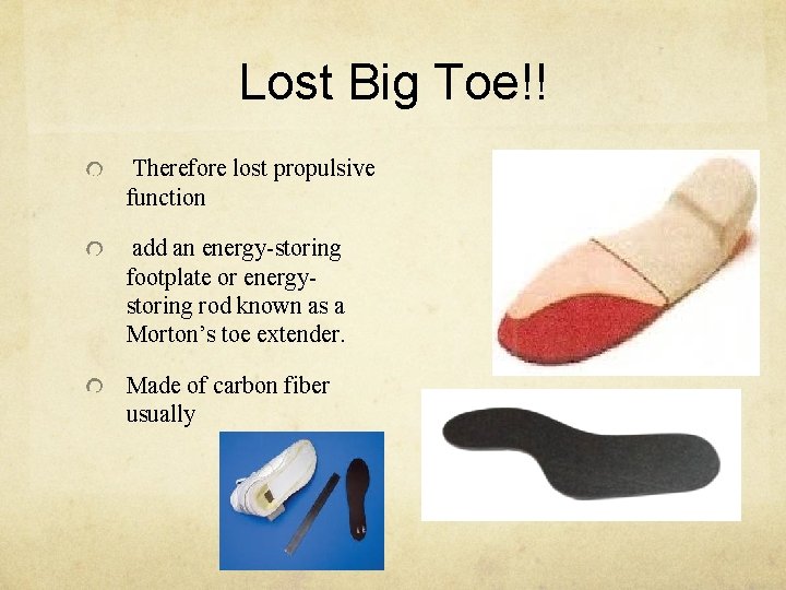 Lost Big Toe!! Therefore lost propulsive function add an energy-storing footplate or energystoring rod
