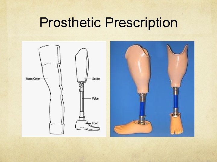 Prosthetic Prescription 