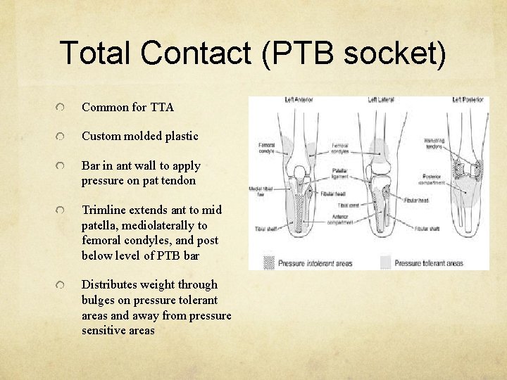 Total Contact (PTB socket) Common for TTA Custom molded plastic Bar in ant wall