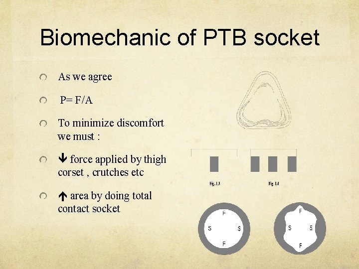 Biomechanic of PTB socket As we agree P= F/A To minimize discomfort we must
