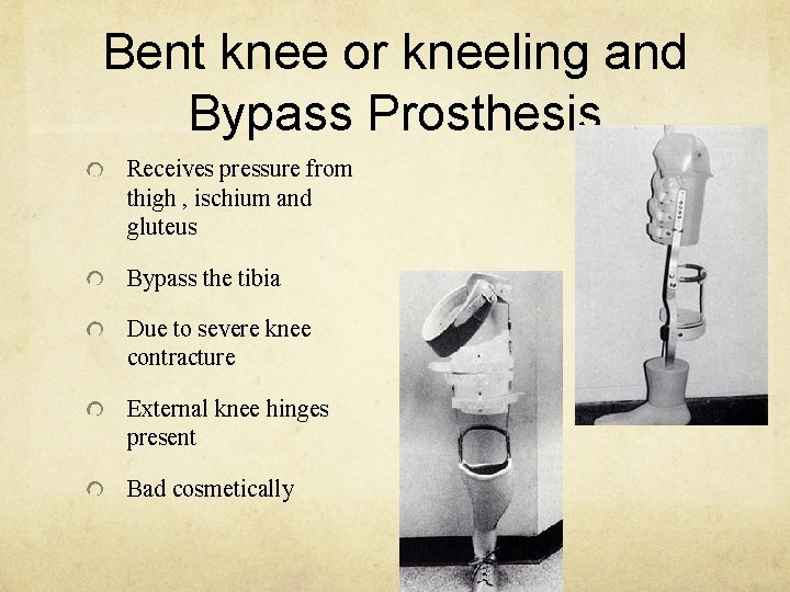 Bent knee or kneeling and Bypass Prosthesis Receives pressure from thigh , ischium and