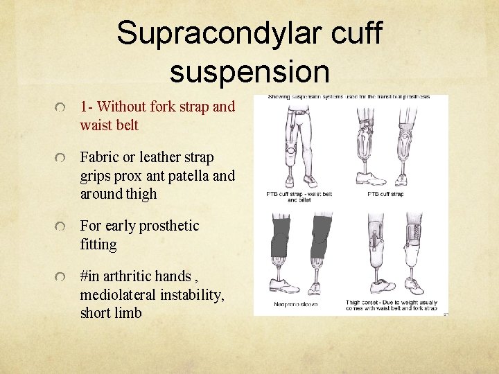Supracondylar cuff suspension 1 - Without fork strap and waist belt Fabric or leather
