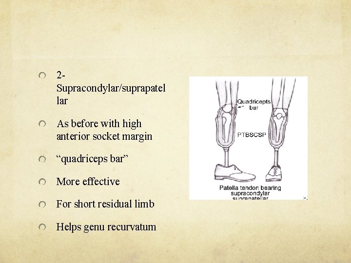 2 Supracondylar/suprapatel lar As before with high anterior socket margin “quadriceps bar” More effective