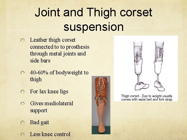 Joint and Thigh corset suspension Leather thigh corset connected to to prosthesis through metal