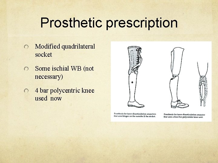 Prosthetic prescription Modified quadrilateral socket Some ischial WB (not necessary) 4 bar polycentric knee