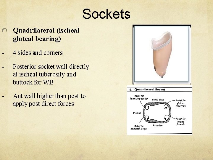Sockets Quadrilateral (ischeal gluteal bearing) - 4 sides and corners - Posterior socket wall