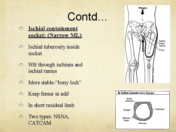 Contd… Ischial containment socket: (Narrow ML) Ischial tuberosity inside socket WB through ischium and