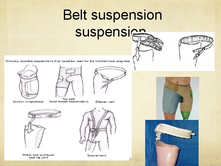Belt suspension 