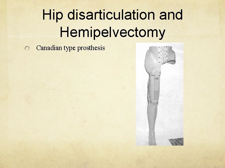 Hip disarticulation and Hemipelvectomy Canadian type prosthesis 