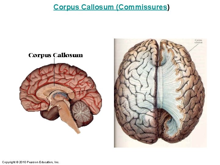 Corpus Callosum (Commissures) Copyright © 2010 Pearson Education, Inc. 