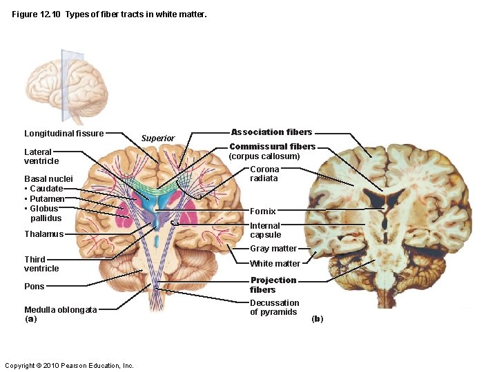 Figure 12. 10 Types of fiber tracts in white matter. Longitudinal fissure Lateral ventricle